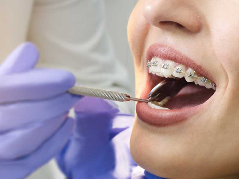 Etkili Diş Bakımı Nasıl Olmalıdır?